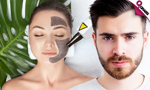 Carbon Peel & Laser Lightening or Toning Treatments!